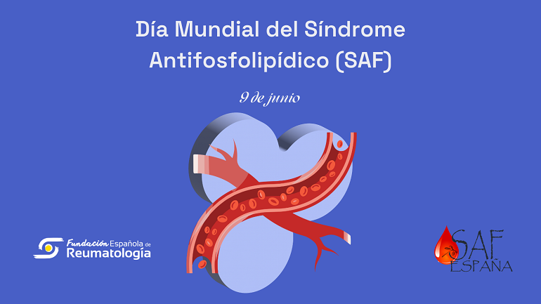 El síndrome antifosfolipídico entra en una nueva etapa de clasificación y tratamiento