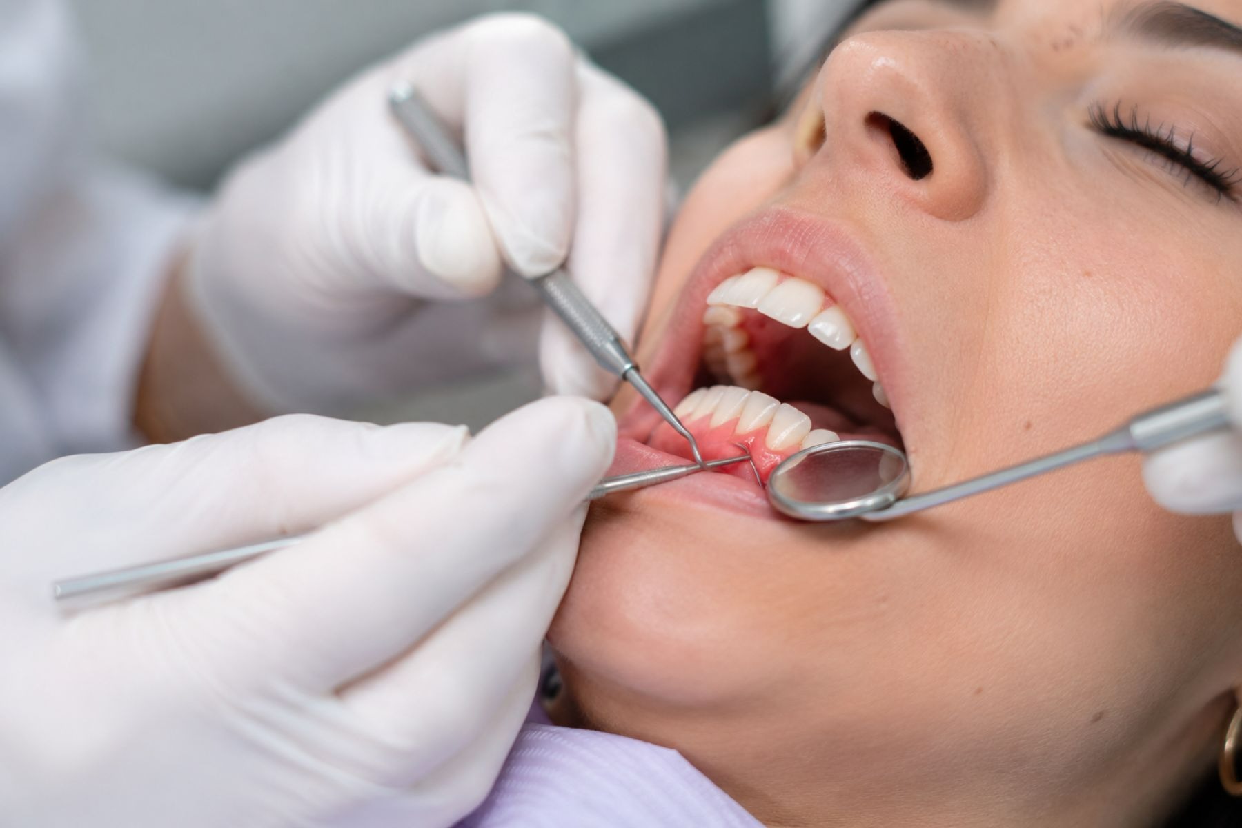 Enfermedad periodontal: qu&eacute; es, por qu&eacute; avanza en silencio y c&oacute;mo se relaciona con la salud general
