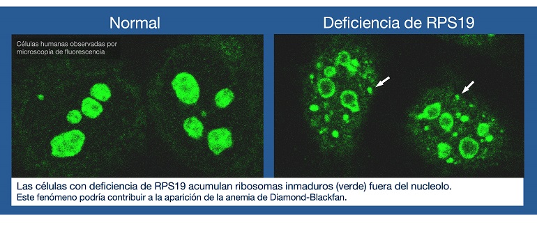 Defectos en la fabricación de los ribosomas explican enfermedades raras de la sangre