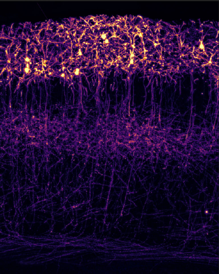 Una proteína coordina cuándo y dónde se establecen las conexiones entre los dos hemisferios del cerebro