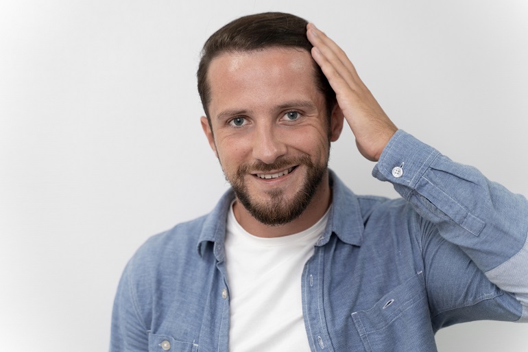 Las prótesis capilares ganan terreno como alternativa frente a la pérdida de cabello