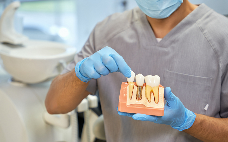 El crecimiento del interés por los implantes dentales y el papel de la innovación tecnológica