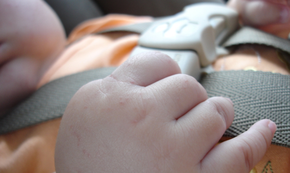 Los pediatras recuerdan que el uso correcto del cinturón reduce hasta en un 55% el riesgo de lesiones por accidente