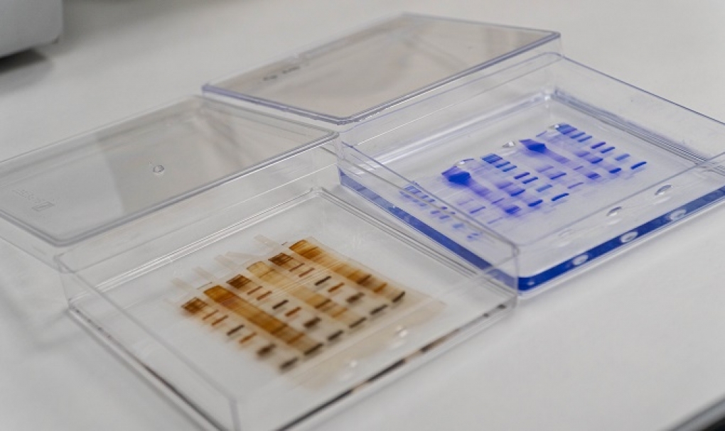 Innovación terapéutica para los síntomas de rinoconjuntivitis en pacientes alérgicos a gramíneas