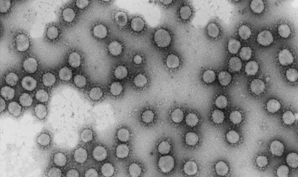 Un solo genotipo del coronavirus generó el 60% de los casos en la primera semana de marzo