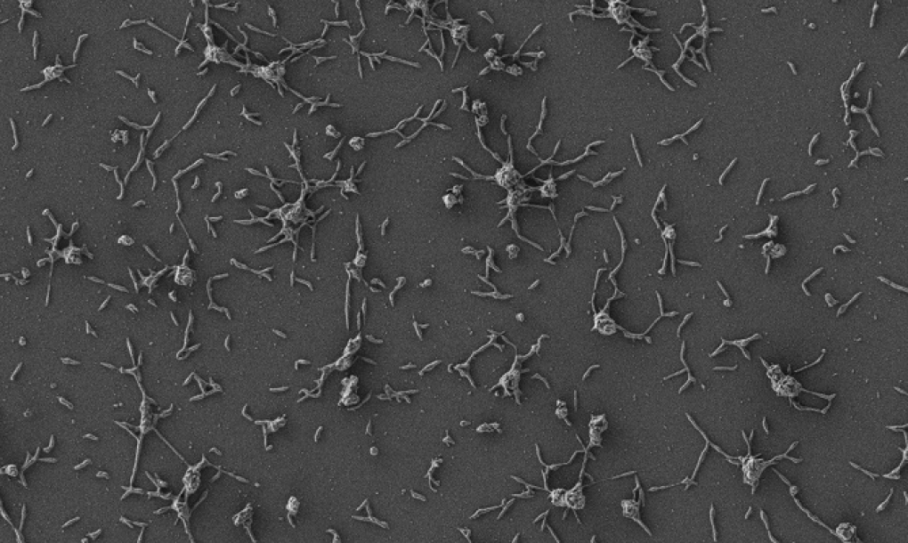 Crean una ‘píldora viva’ para tratar infecciones resistentes a los antibióticos