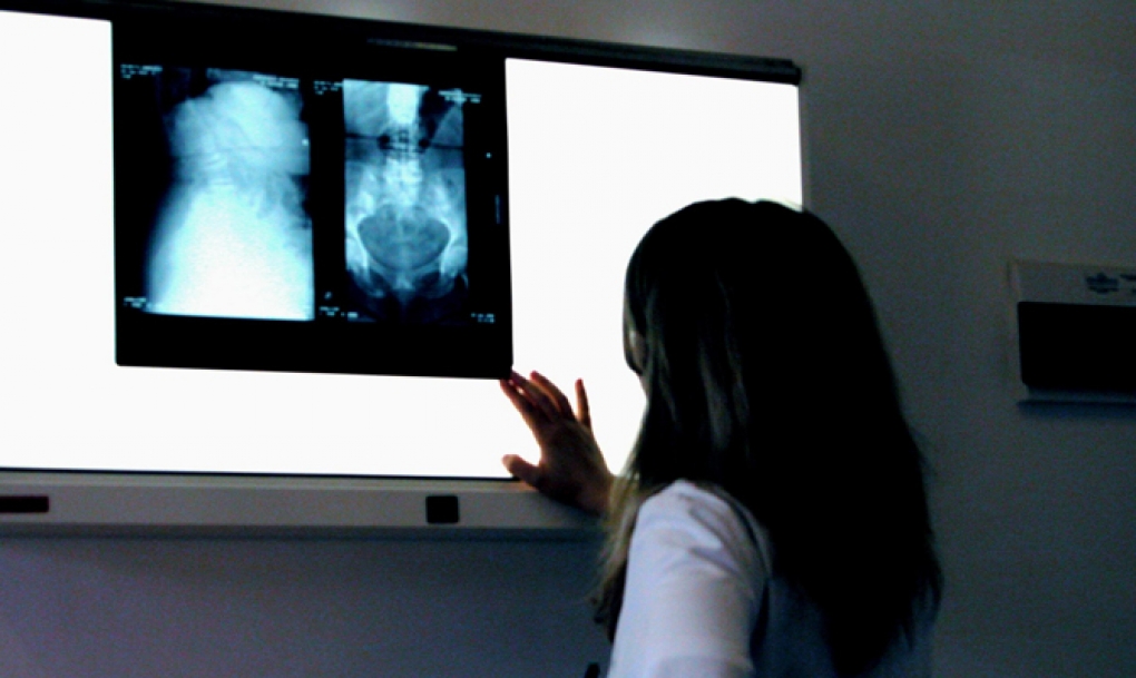 CCOO pide que la gestión de las pruebas radiológicas sea asumida por el sistema público