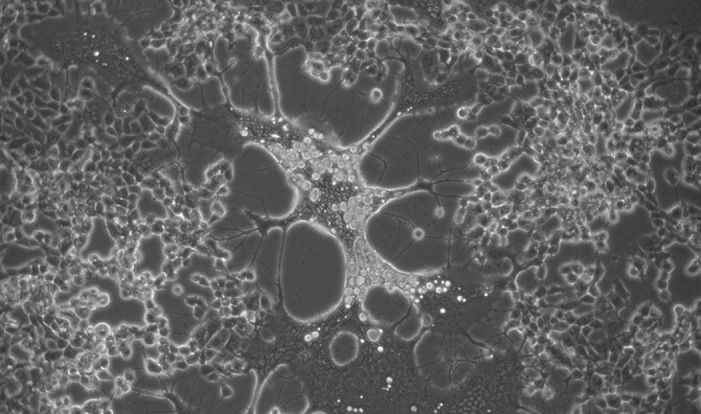 El virus del herpes genital humano evoluciona más rápido que el labial