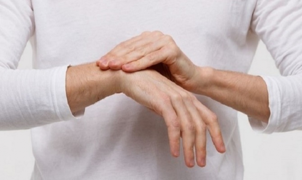 La artritis reumatoide requiere un abordaje multidisciplinar para evitar posibles complicaciones como la afectación pulmonar