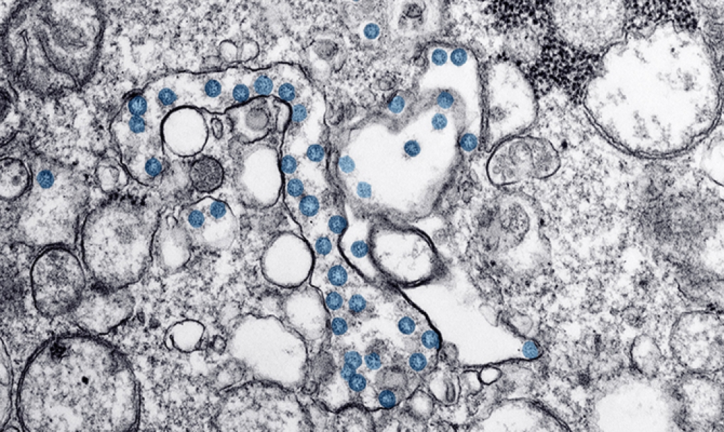 Investigadores del CSIC obtienen un nanomaterial que elimina el coronavirus y puede aplicarse en mascarillas y tejidos
