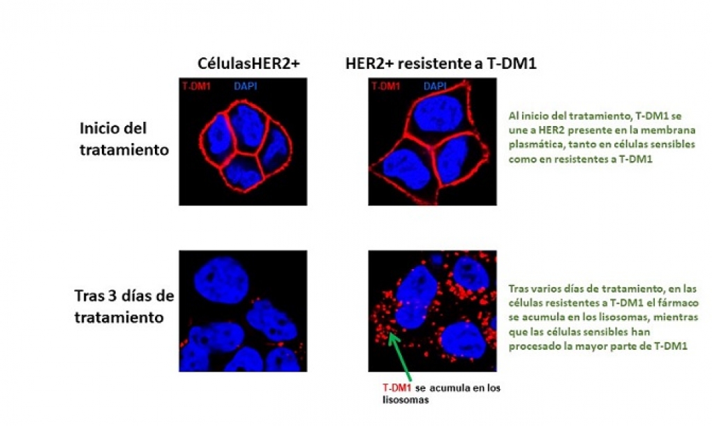 Investigadores descubren un mecanismo de resistencia a un fármaco muy eficaz contra un tipo de cáncer de mama