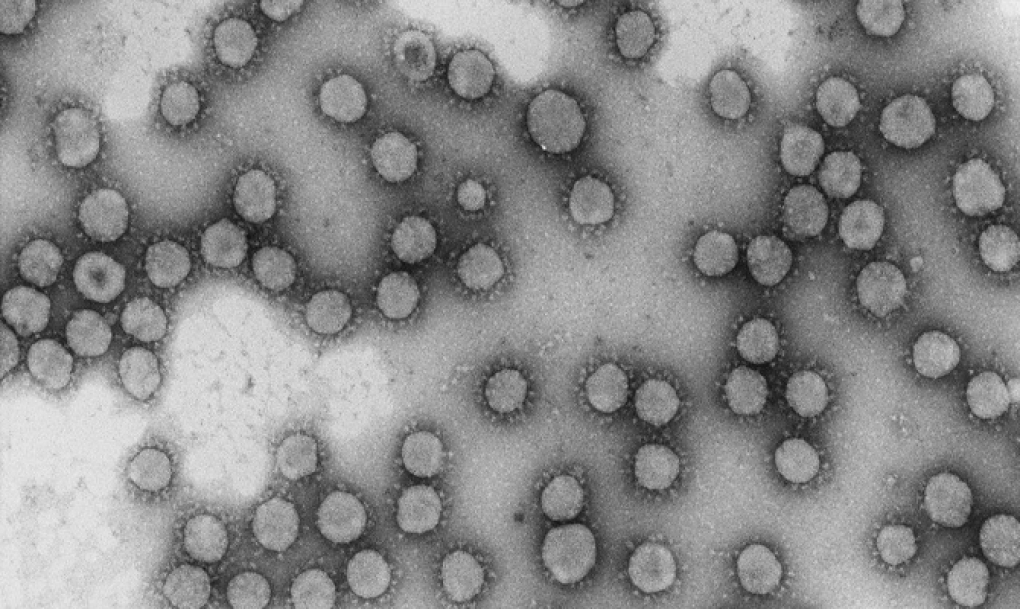 Dos proyectos del CSIC obtienen financiación europea urgente para investigar el coronavirus de Wuhan
