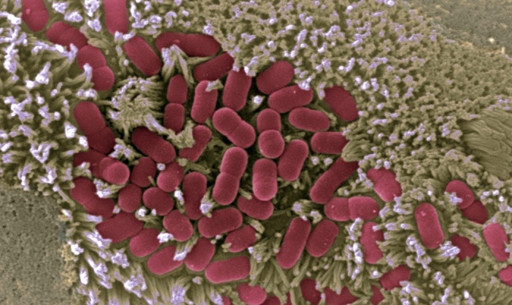 Descifrado cómo las bacterias usan redes de proteínas para controlar a las células durante la infección