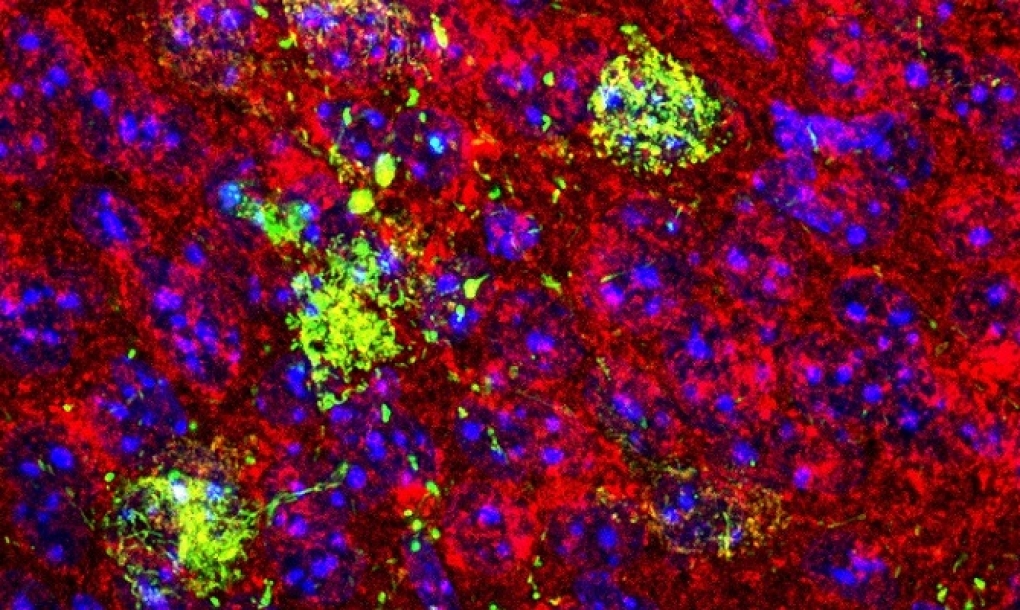 Descifran en ratones alteraciones en las neuronas que favorecen la obesidad