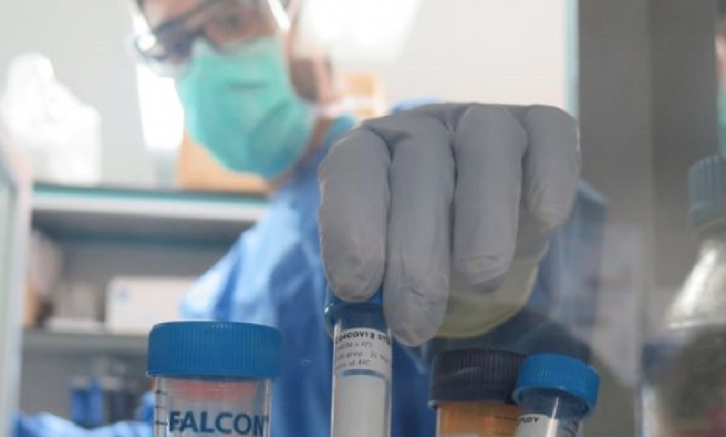 El 10% de las personas con infección grave por SARS-CoV-2 generan anticuerpos que boicotean su propio sistema inmunitario