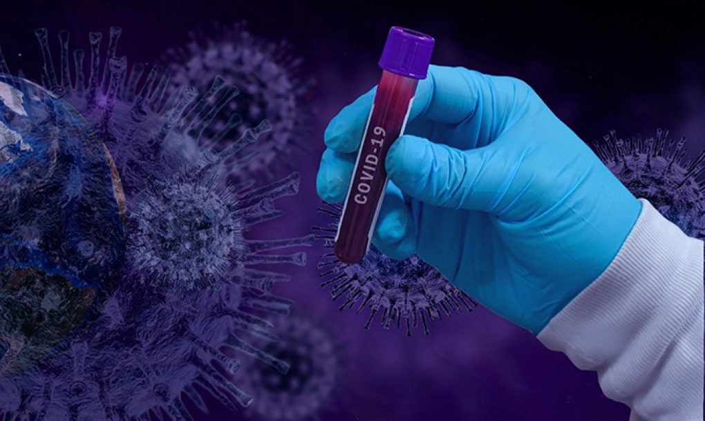Sanidad pone los laboratorios privados a disposición de las CCAA para controlar las pruebas de detección del SARS-CoV-2 y evitar abusos