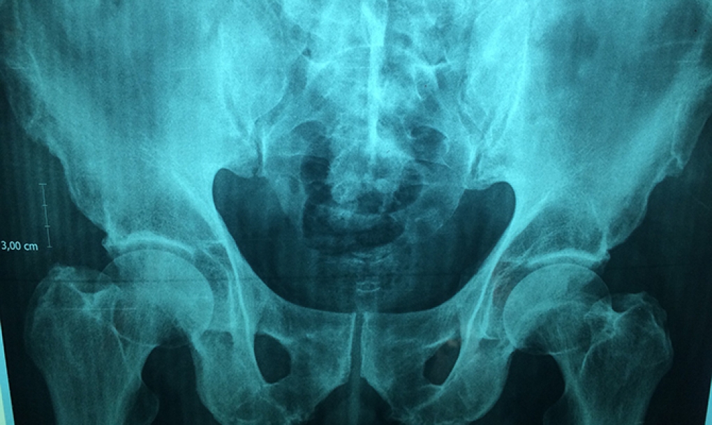 La radiología intervencionista ahorra costes al sistema sanitario
