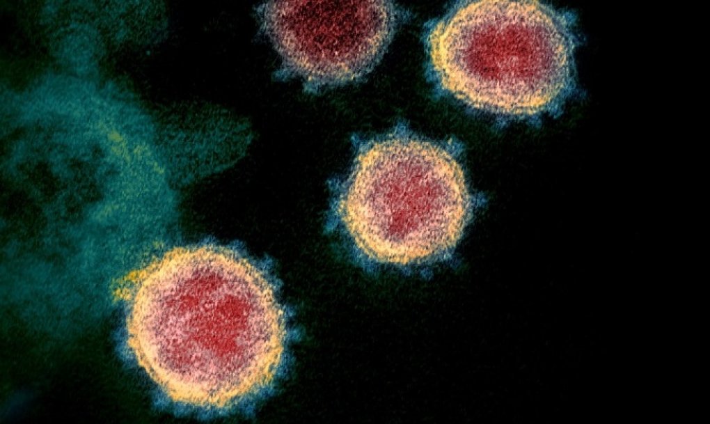 Un fármaco evita la reproducción del SARS-CoV-2 en las células