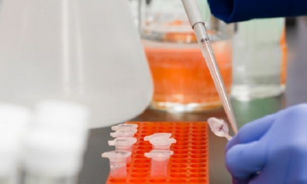 Desarrollo de anticuerpos sintéticos para impedir la infección por SARS-CoV-2