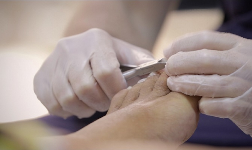 El 94% de las mujeres con cáncer de mama sometidas a quimioterapia presenta problemas en los pies