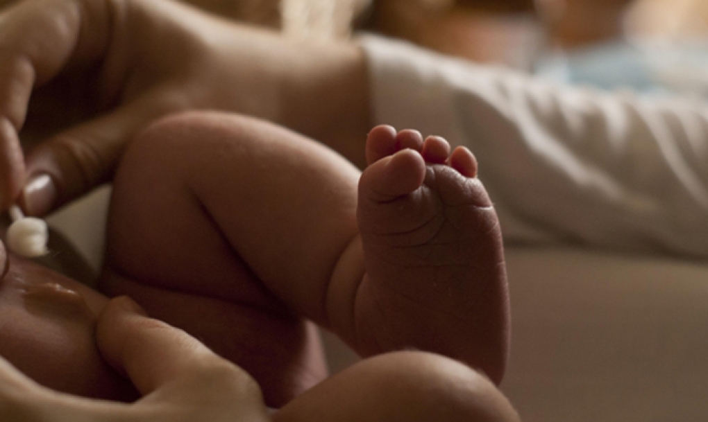 Ascienden a 23 los bebés afectados por el síndrome del hombre lobo por el falso omeprazol