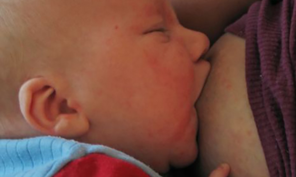 Pediatras de Primaria piden ampliar el permiso de maternidad hasta los 6 meses