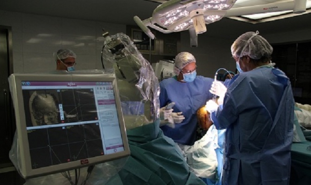 Primera cirugía láser en España para tratar la epilepsia y tumores cerebrales