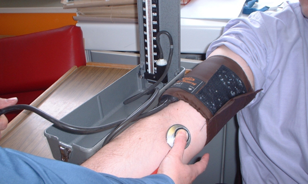 Controlar la hipertensión arterial podría retrasar el desarrollo de alzheimer y demencia vascular