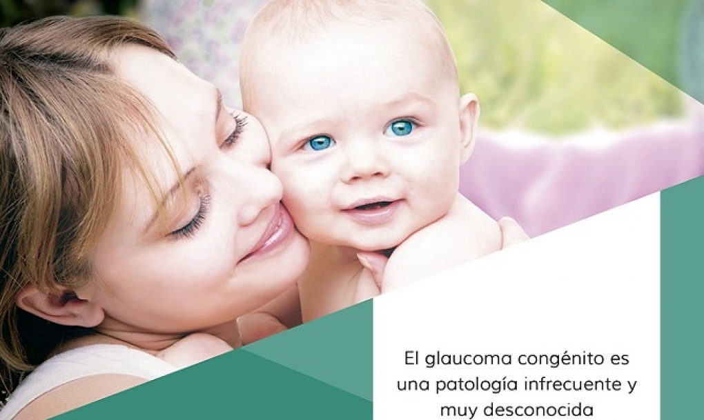40 niños son diagnosticados de glaucoma congénito en España cada año