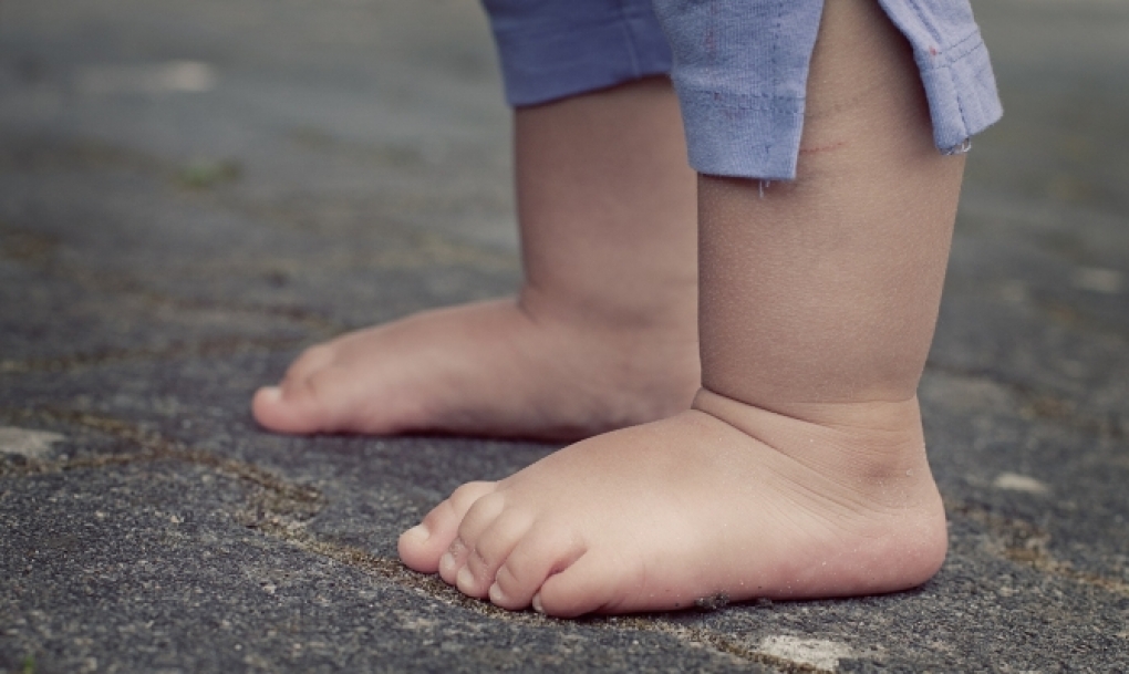 Los menores de un año son los más propensos a sufrir golpes de calor