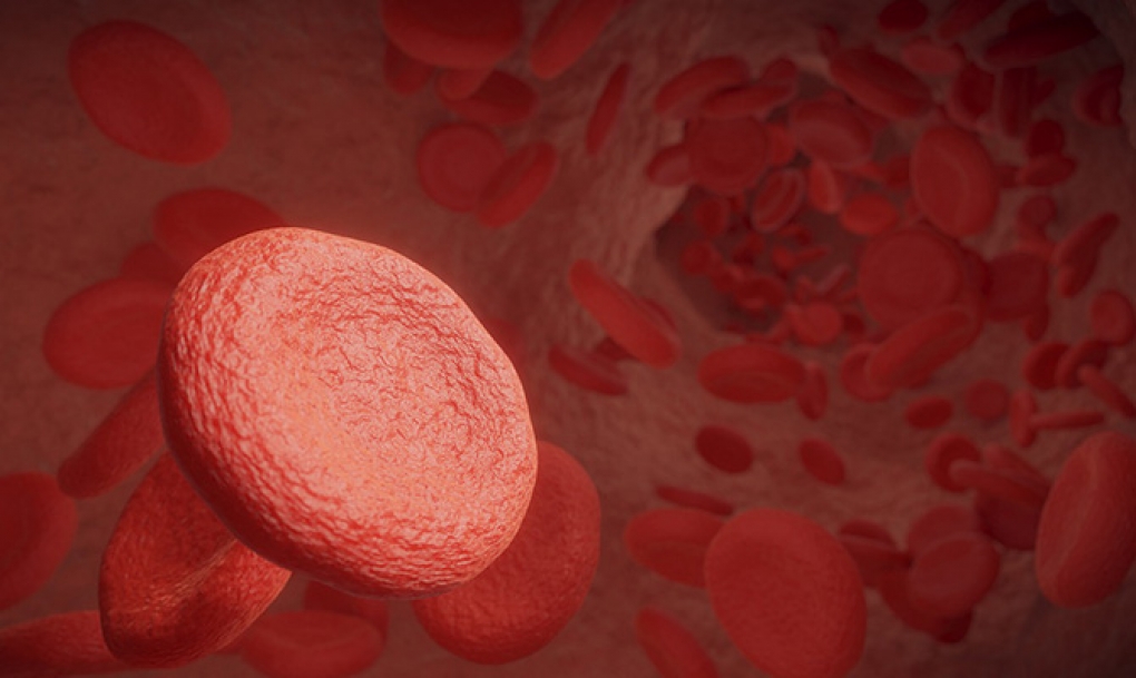 Una nueva técnica de análisis del suero sanguíneo podría predecir complicaciones en casos de hipercolesterolemia familiar