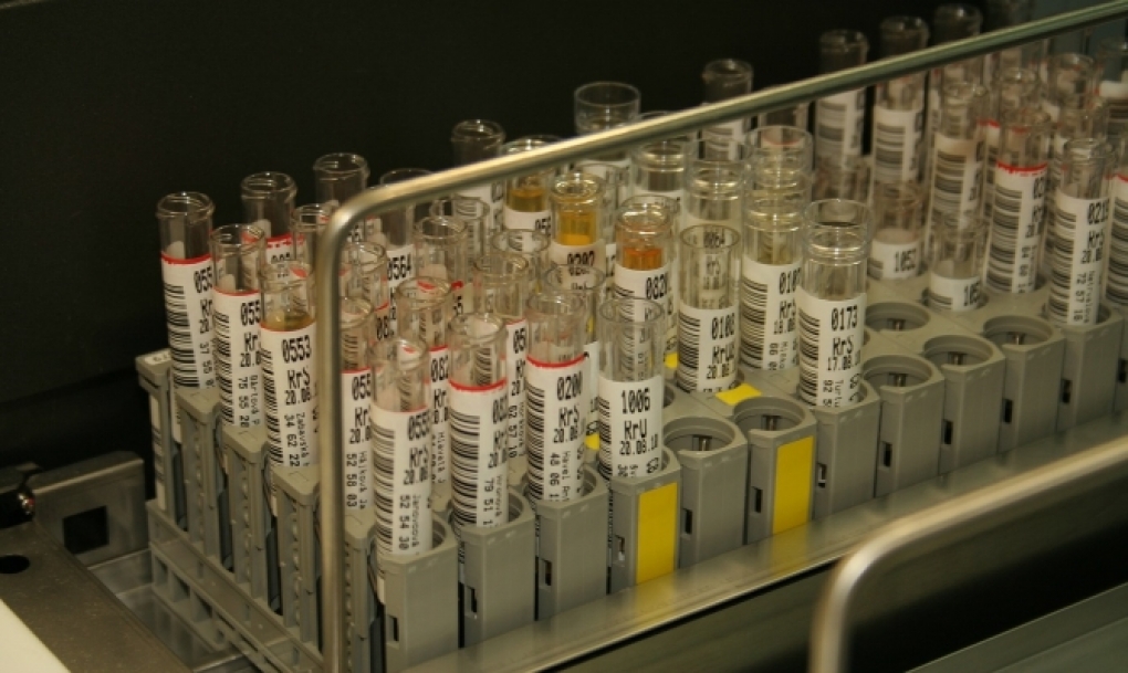 Una nueva guía reúne todo lo que el laboratorio clínico debe conocer sobre los análisis de orina