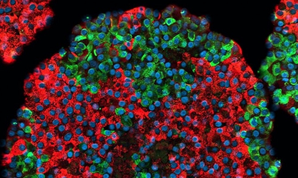 Un equipo científico crea por primera vez células beta pancreáticas funcionales a partir de células madre