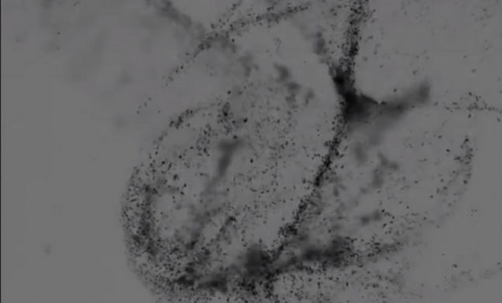 Nanorrobots para localizar y combatir el cáncer