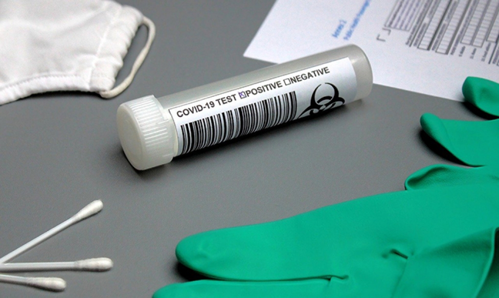 La covid-19 deja siete muertes más en Castilla y León, que registra 142 nuevos casos de coronavirus