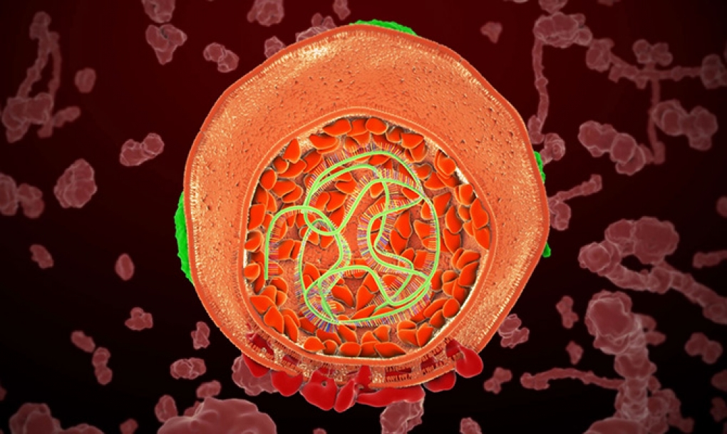 Un estudio confirma la reducción de la mortalidad por hepatitis C gracias a los nuevos antivirales