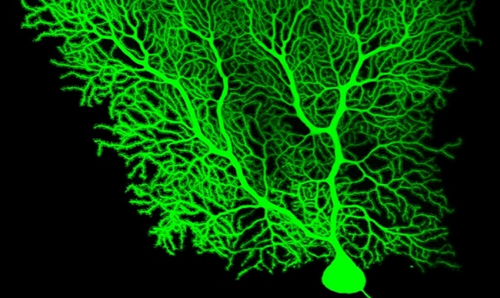 Un estudio confirma que el cerebelo participa en tareas cognitivas y afectivas