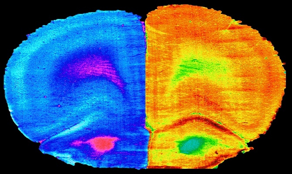 El deporte y el consumo de un nuevo probiótico mejoran la cognición de los enfermos hepáticos