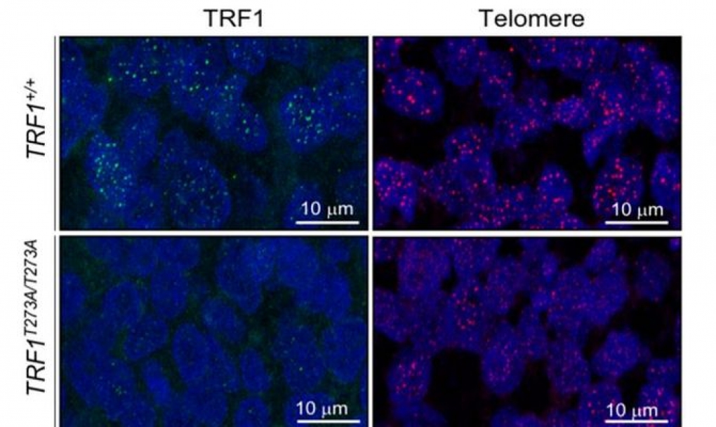 Descubren cómo se regula la participación de los telómeros en la generación de tumores