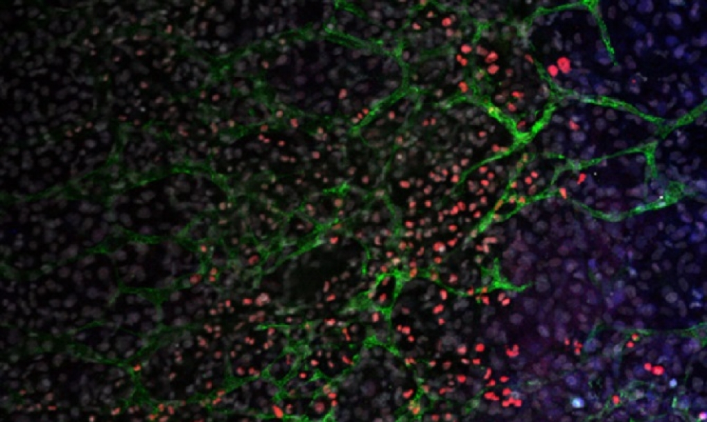 Tecnología rápida y sencilla para conseguir células madre más eficientes en medicina regenerativa