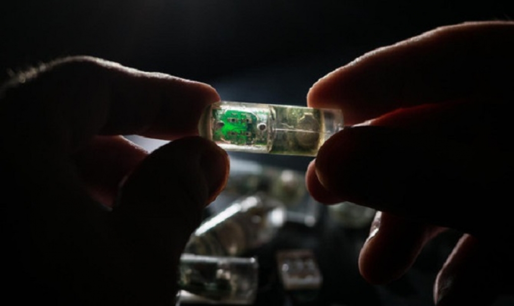 Un sensor que se podrá tragar para detectar enfermedades digestivas