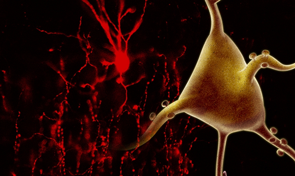 El riesgo genético de la esquizofrenia, sin relación con las estructuras subcorticales del cerebro