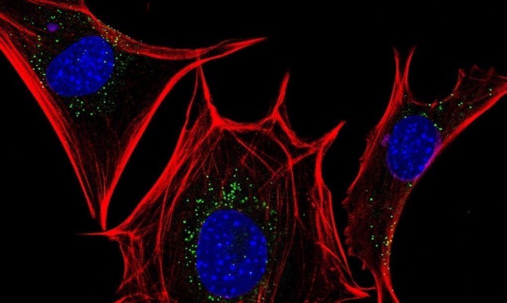La interacción entre dos proteínas celulares, posible diana frente al cáncer