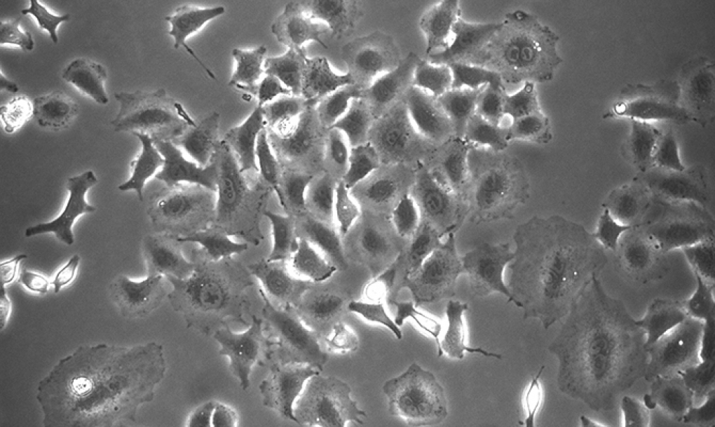 Prueban fármacos usados contra el cáncer para frenar la infección por coronavirus