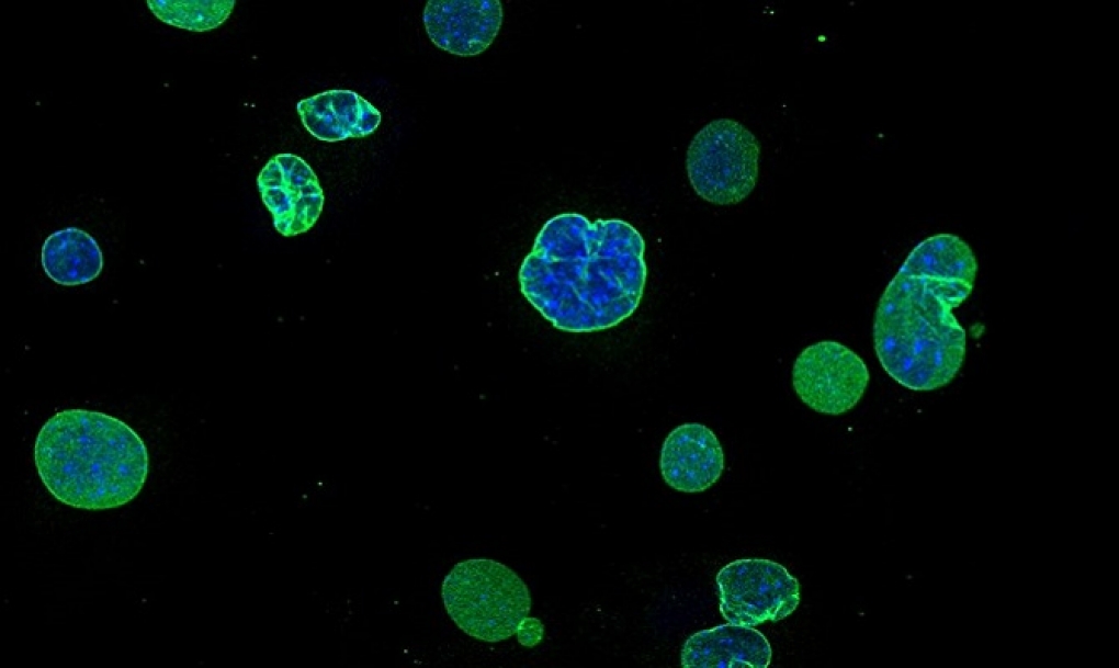 Investigadores españoles desarrollan una nueva terapia génica para el envejecimiento acelerado