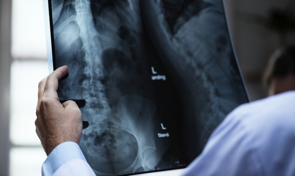 Los sistemas de radiología directa reducen a la mitad el tiempo necesario para las pruebas de rayos X