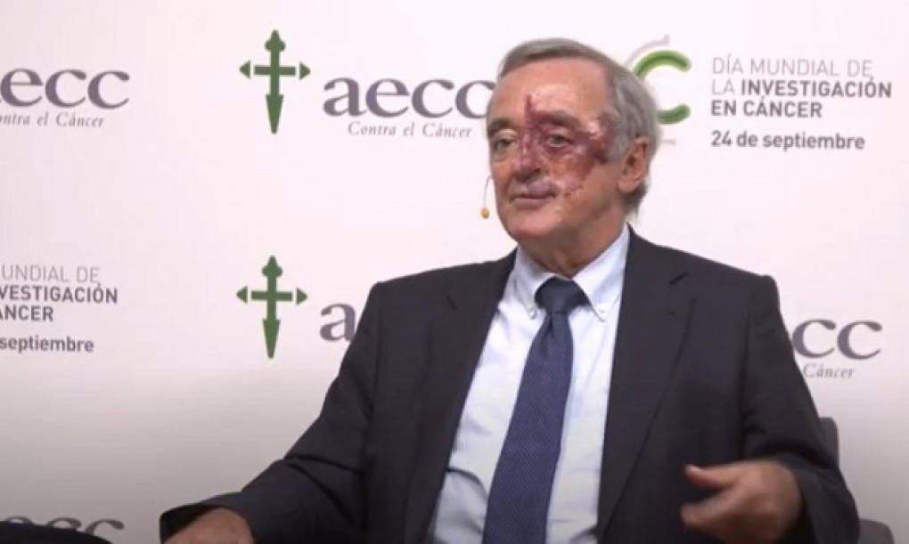 «España tiene muy buenos investigadores en cáncer, pero sin recursos»