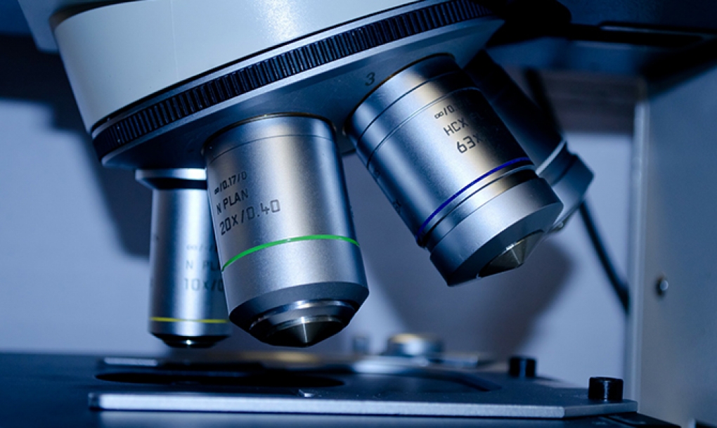 Identifican un nuevo mecanismo de activación de oncogenes que permite un diagnóstico más preciso de uno de los linfomas más agresivos