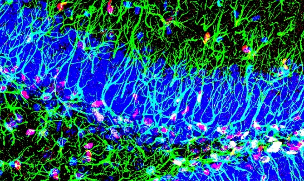 Descubierto un nuevo mecanismo para activar las c&eacute;lulas madre del cerebro adulto