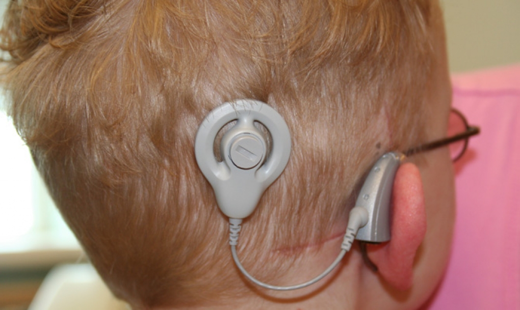 El cribado de la hipoacusia infantil diagnostica en la Comunidad a cuatro niños con una sordera mayor de 35 db